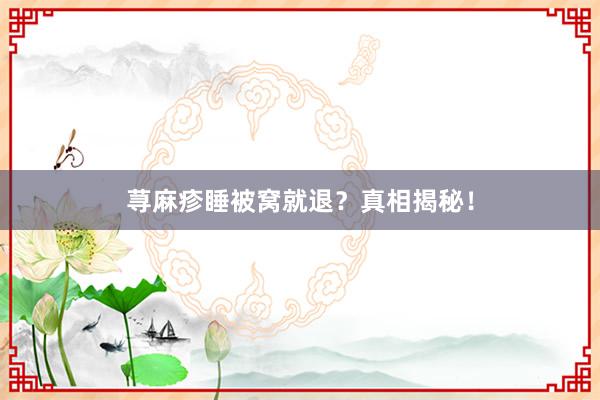 荨麻疹睡被窝就退?真相揭秘!